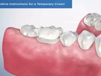 Post-Operative Instructions for a Temporary Crown