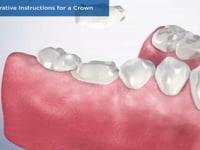 Post-Operative Instructions for a Crown