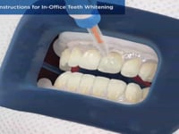 Post-Op Instructions for In-Office Teeth Whitening