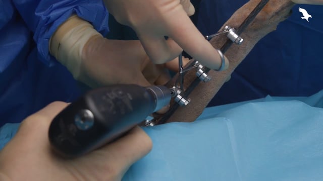 Application of a type Ib external fixator to the radius