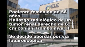 NEFRECTOMIA RADICAL LAPAROCOPICA DERECHA CON TROMBO NIVEL II