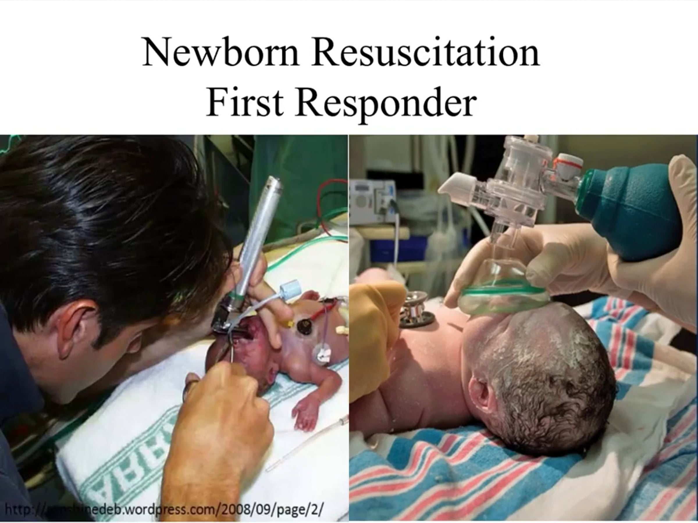 Newborn Resuscitation | Videos & Movies on Vimeo