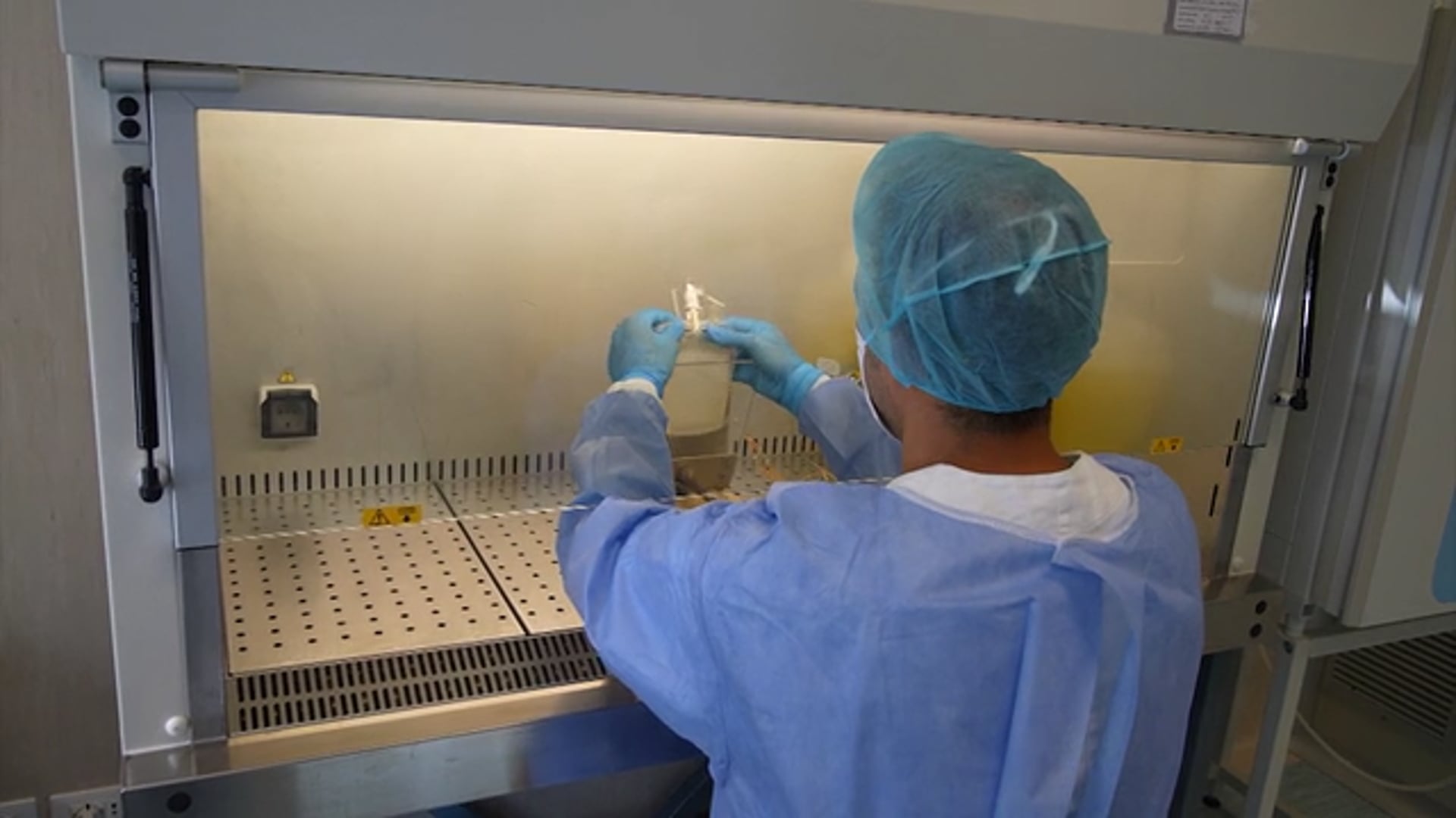 La vitamina A cura efficace contro il tumore cerebrale