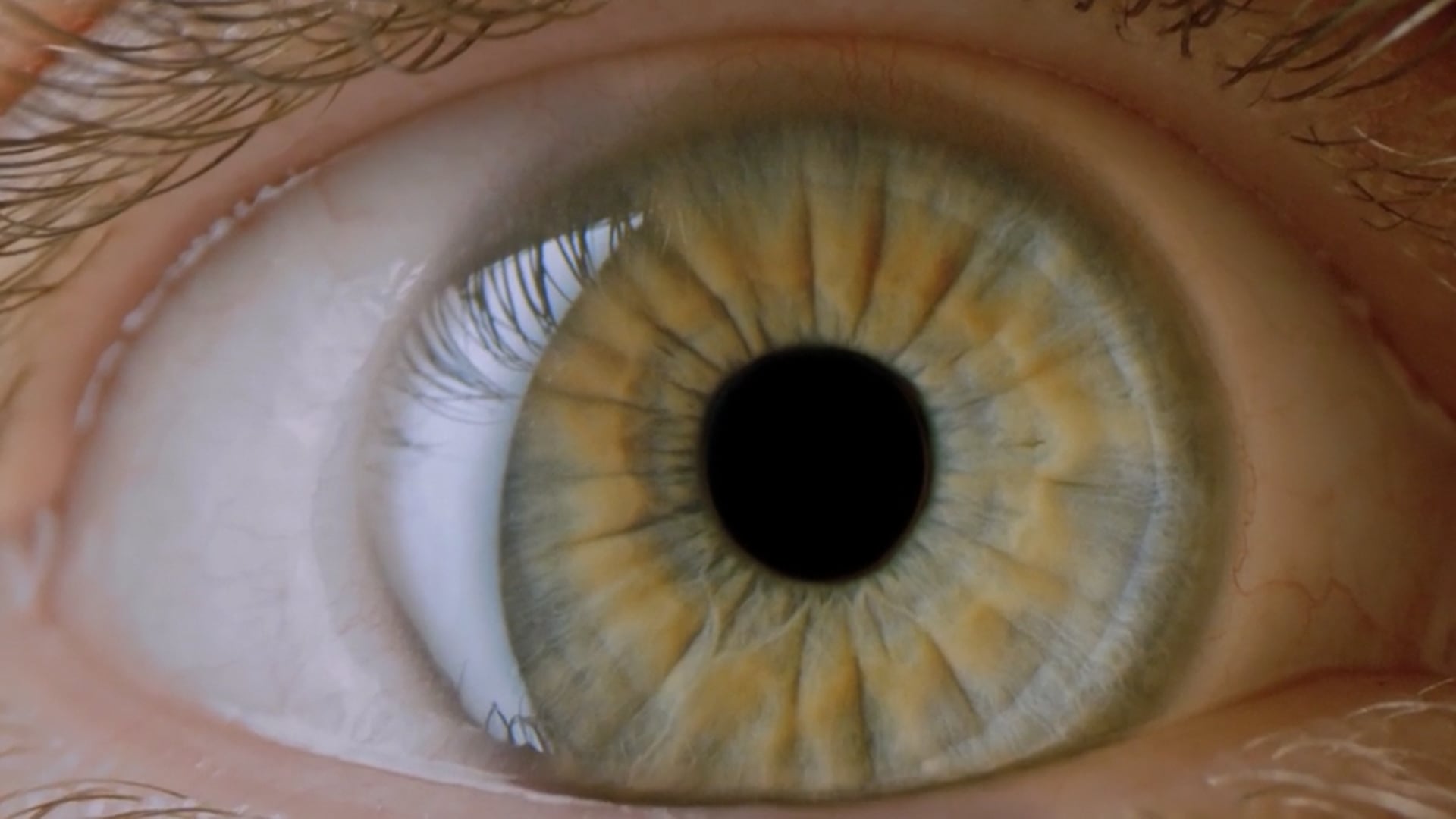 Accelerating Progress for LHON