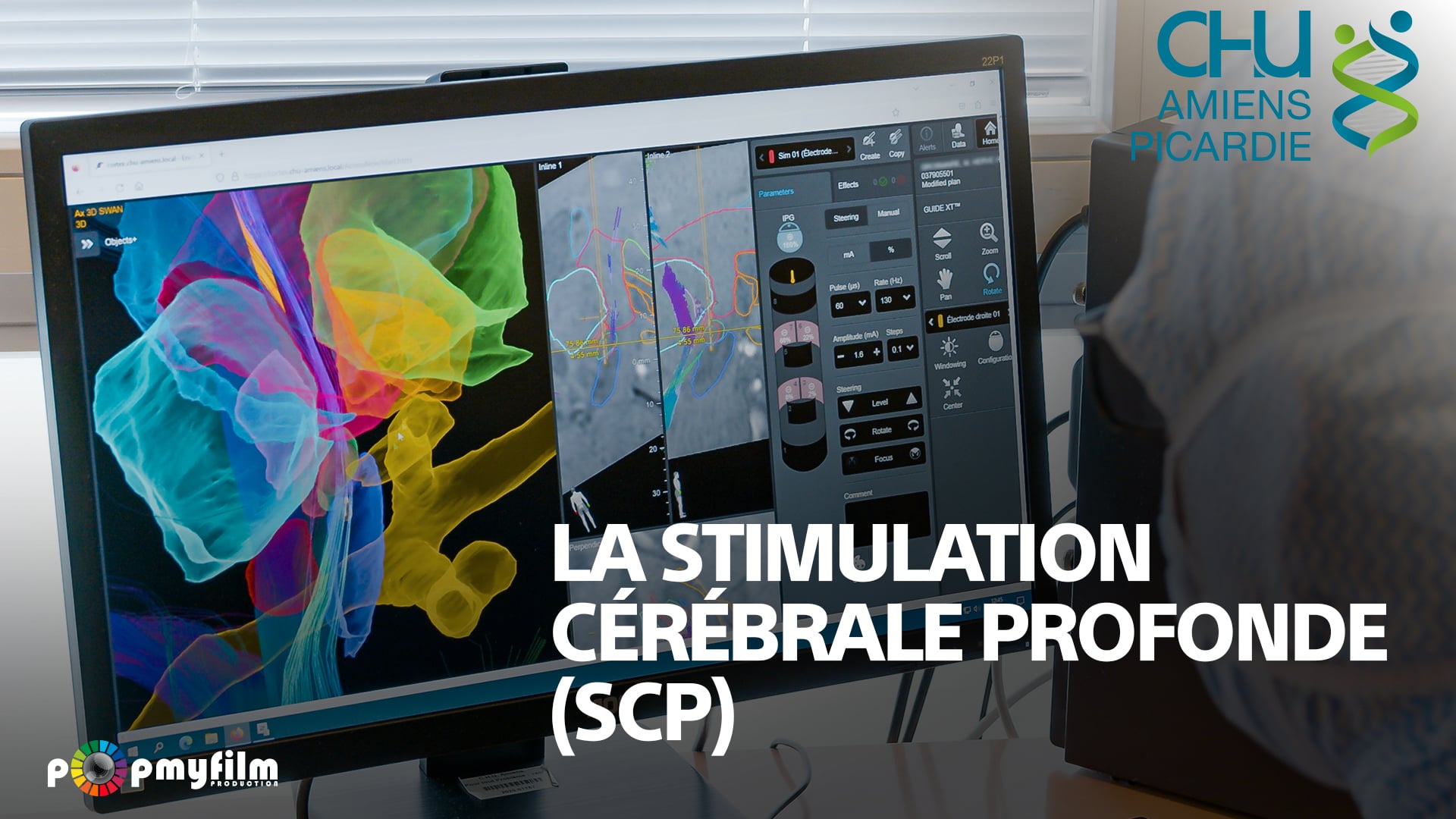 Public / Amiens / Neuro / La SCP / V1