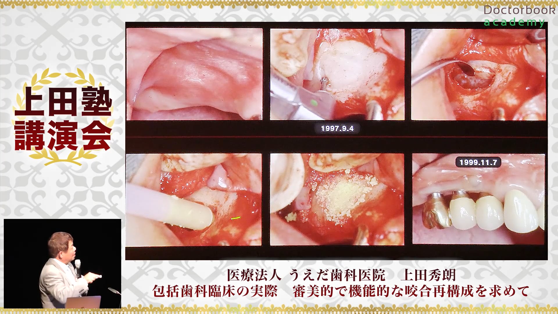 包括歯科臨床の実際 審美的で機能的な咬合再構成を求めて