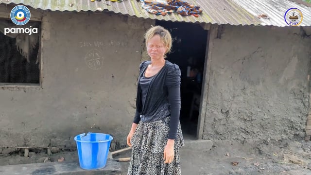 Les albinos d’Isangi lancent un cri d’alarme