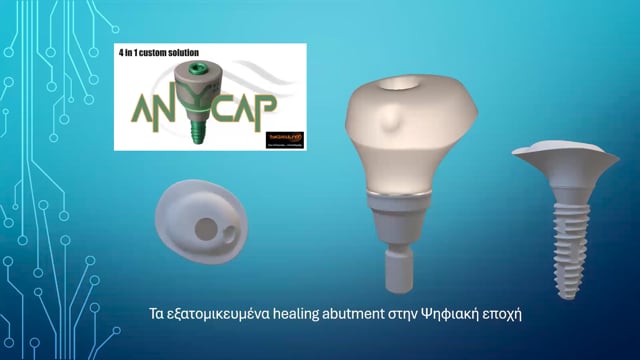 AnyCap: Εξατομικευμένα healing abutment χωρίς όρια.