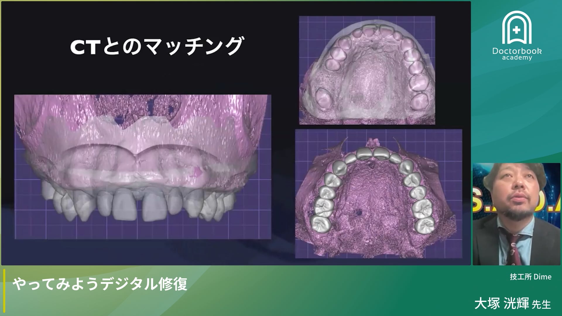 やってみようデジタル修復