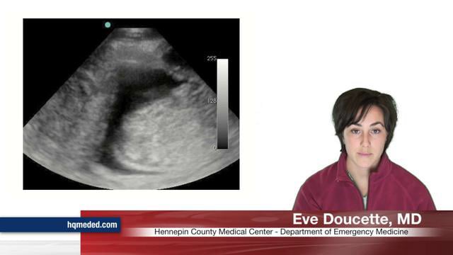 Hennepin Ultrasound