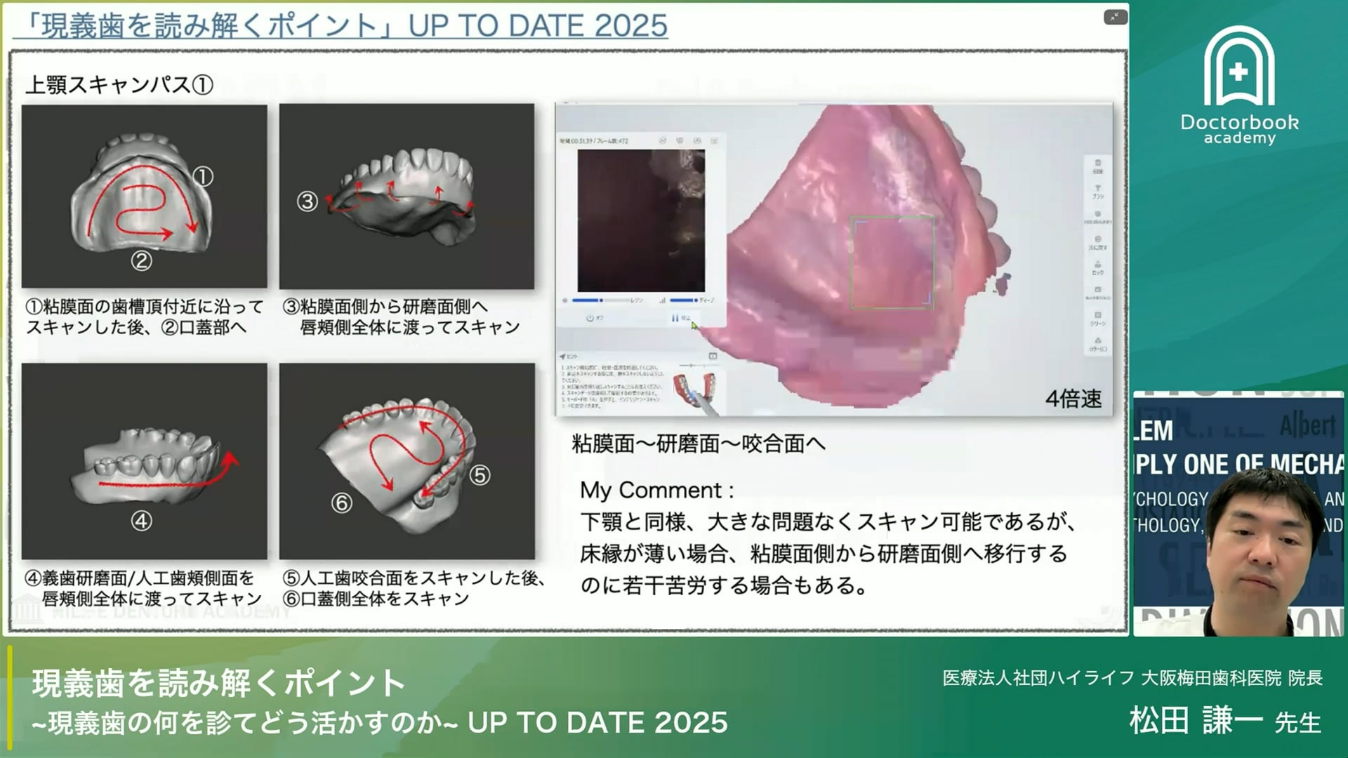 The Seminar！現義歯を読み解くポイント~現義歯の何を診てどう活かすのか~ UP TO DATE 2025