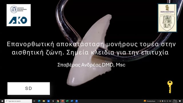 Επανορθωτική αποκατάσταση μονήρους τομέα στην αισθητική ζώνη: Σημεία κλειδιά για την επιτυχία.