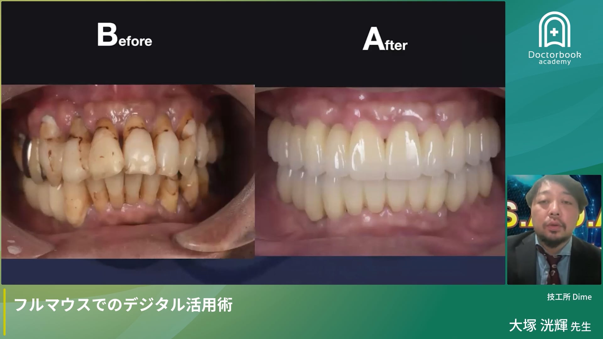 フルマウスでのデジタル活用術