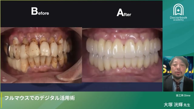 フルマウスでのデジタル活用術