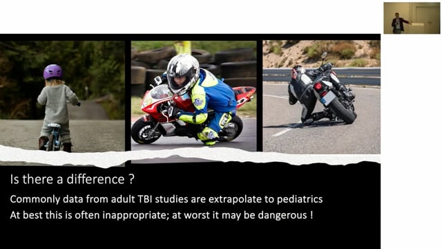 Surgical treatment of Traumatic Brain Injury in Children