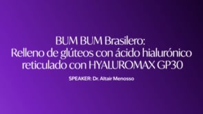 04 - Bum Bum Brasilero