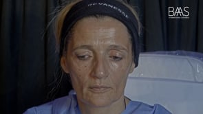 06 - Workshop Revanesse