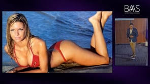 10 - Bioestimulacion glutea con bioestimuladores y relleno con AH