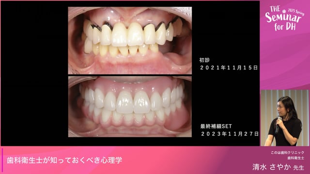 歯科衛生士が知っておくべき心理学