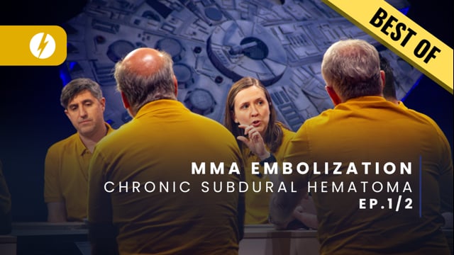BEST OF MMA Embolization - Chronic subdural hematoma - Ep.1/2