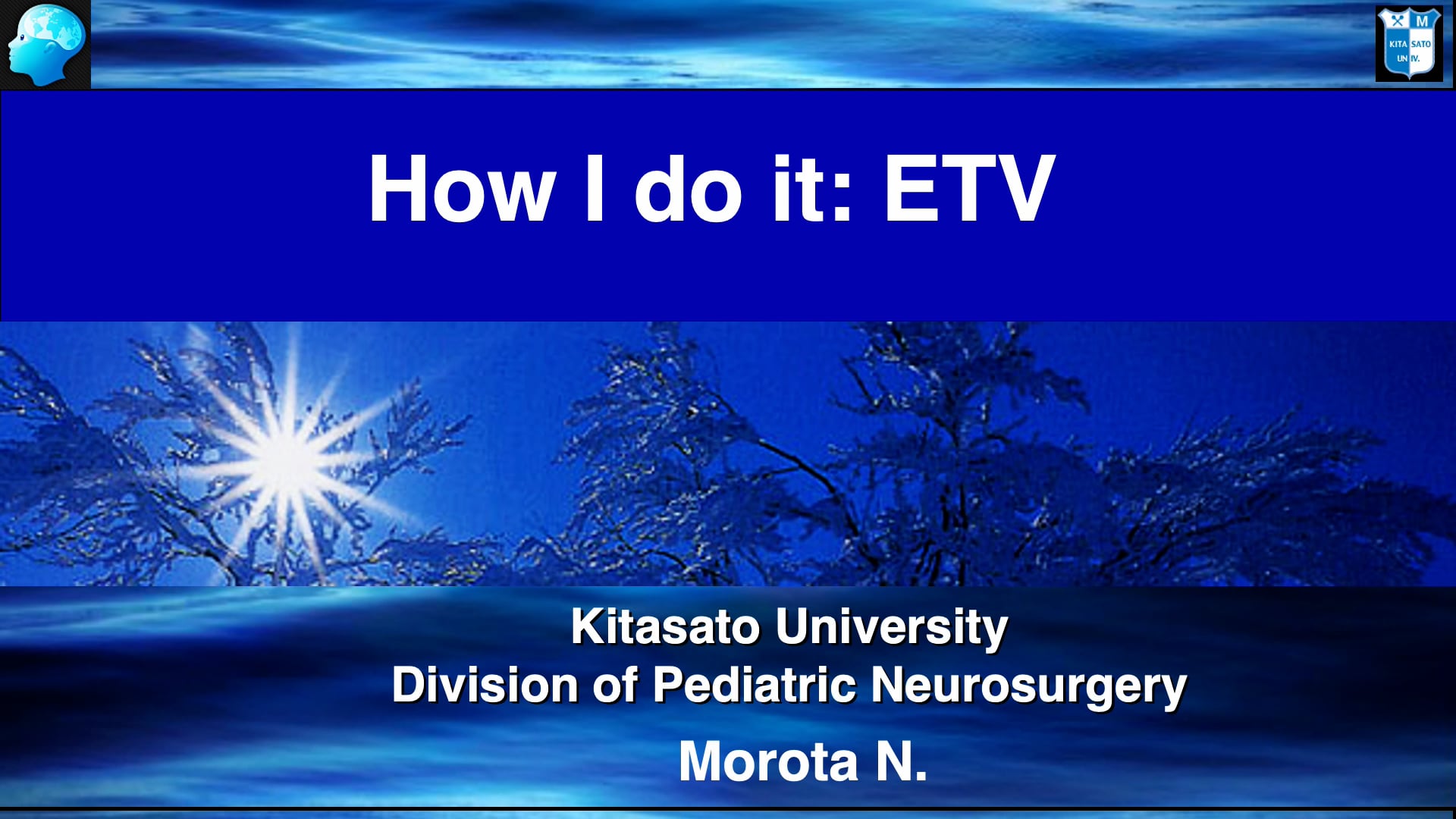 How do I do it: Endoscopic third ventriculostomy (ETV)