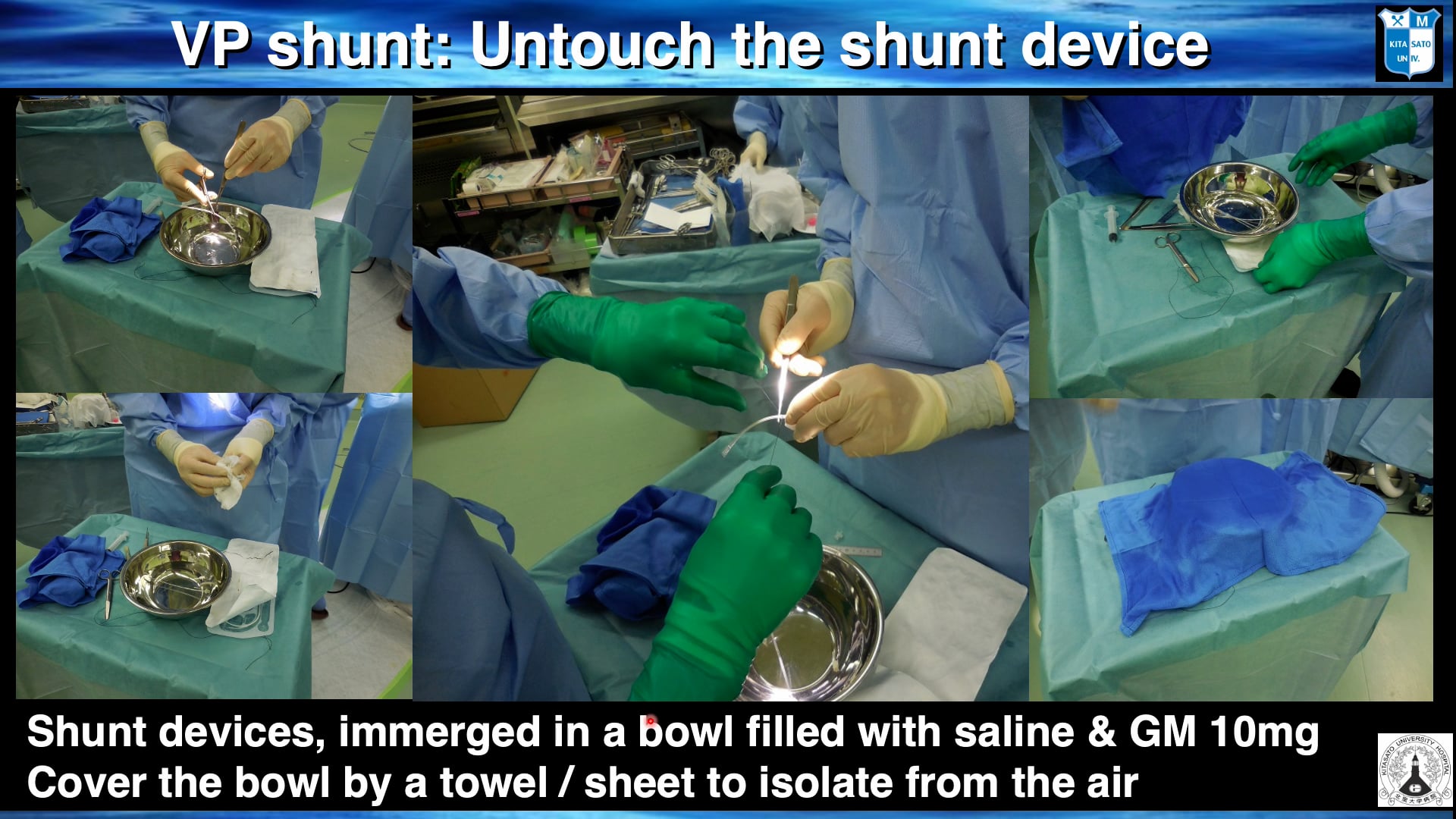 How do I do It – Ventricular Shunt Placement (VP or VA)