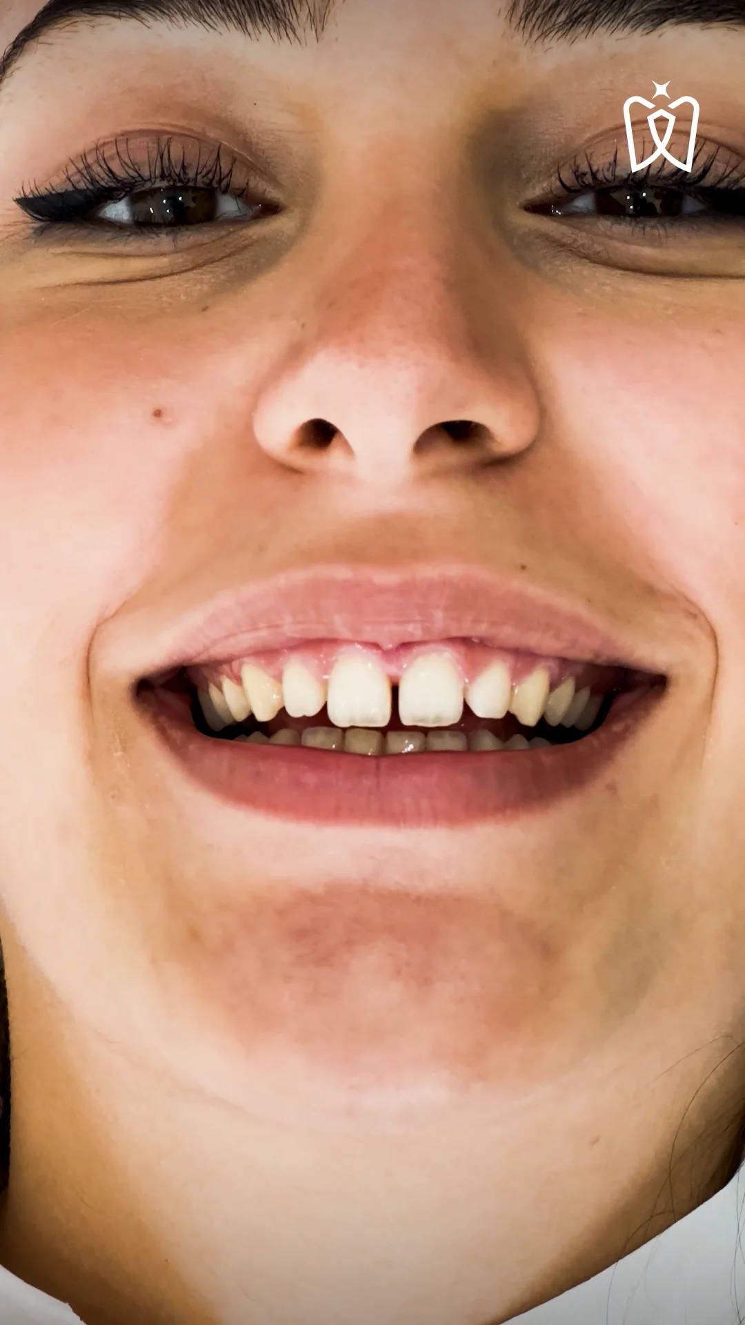 Zeynep Lamina, image size:1080x1920