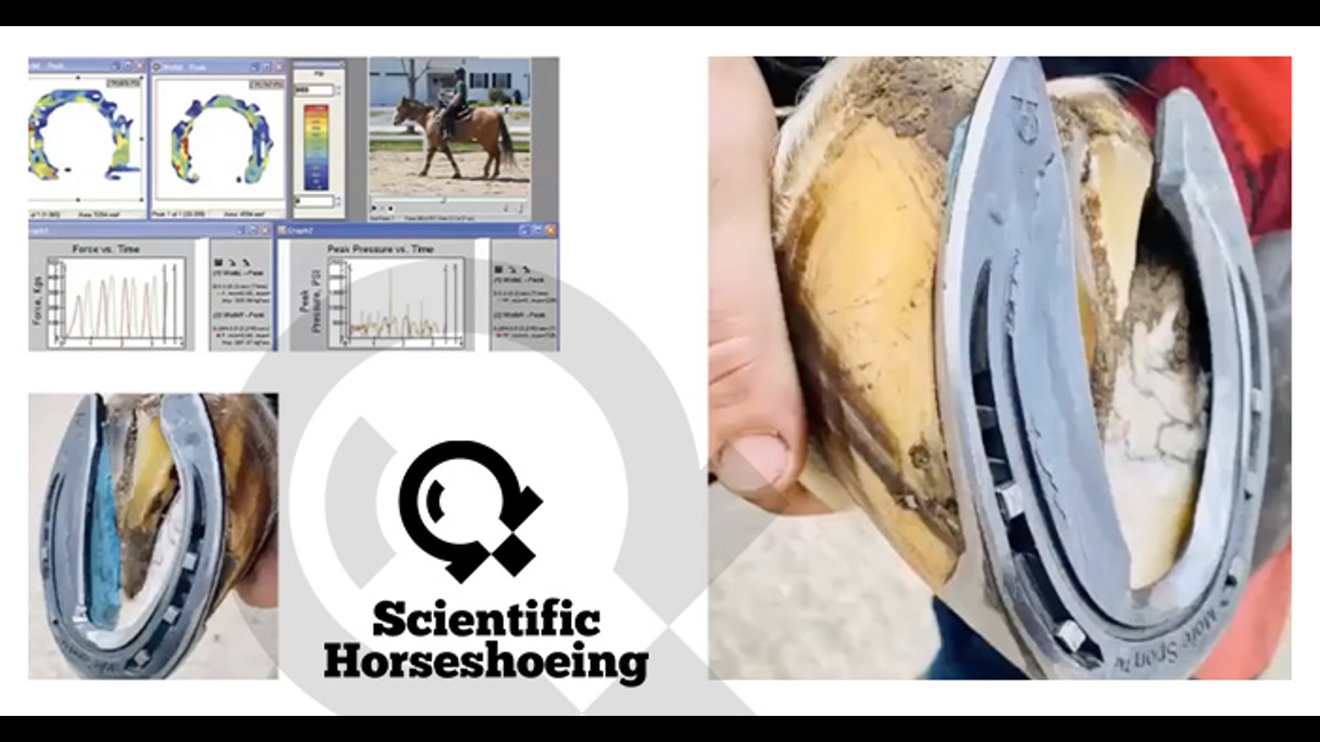 An Anatomical Perspective on Applying in Shoe Prothetic Insert with Paul Conroy Bsc (Hons)