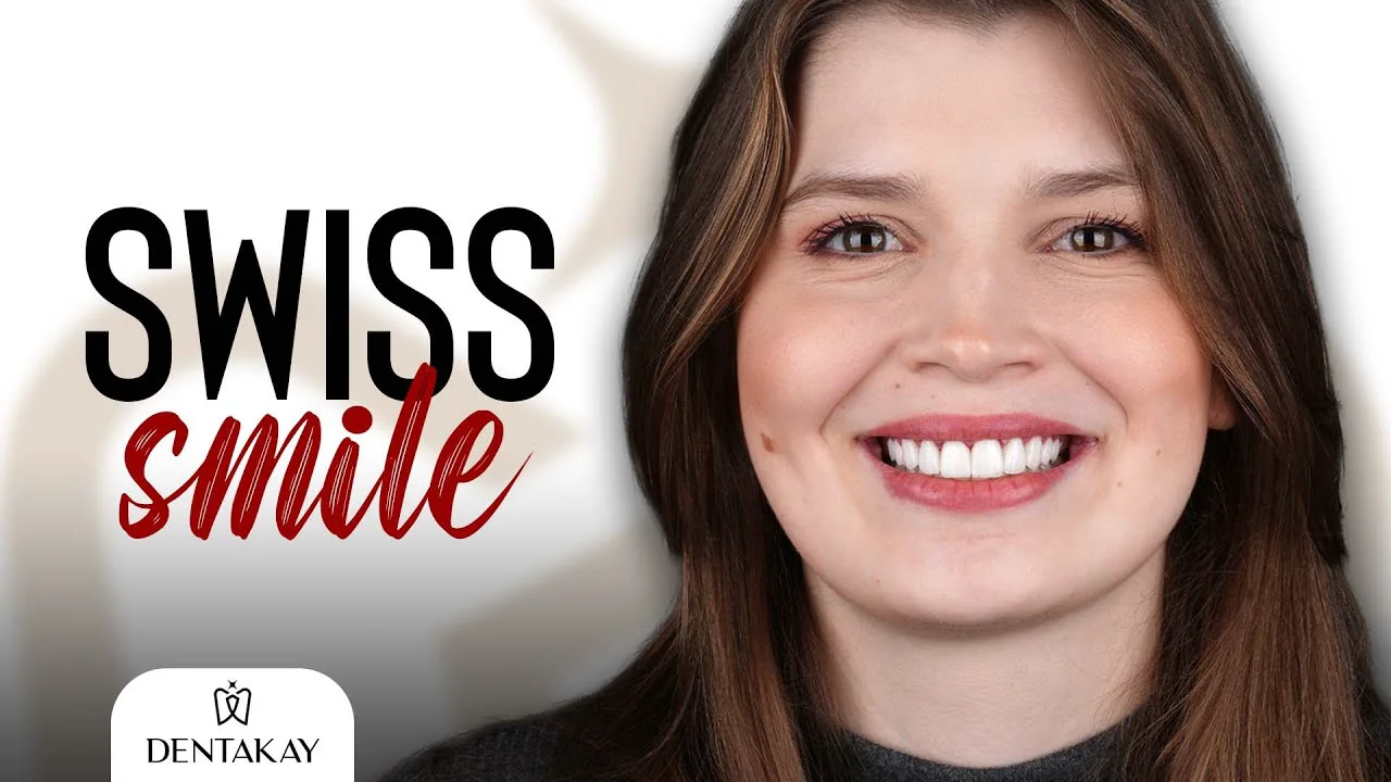 Aline From Switzerland fixed her SMILE in TURKEY!, image size:1280x720