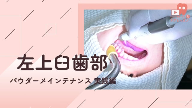 05.左上臼歯部