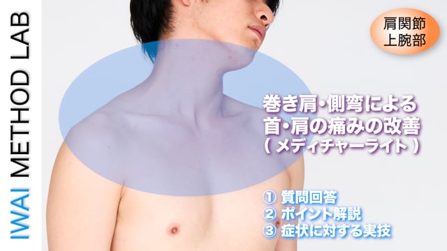 治療実例「巻き肩・側弯による首・肩の痛みの改善（メディチャーライトでの治療）」