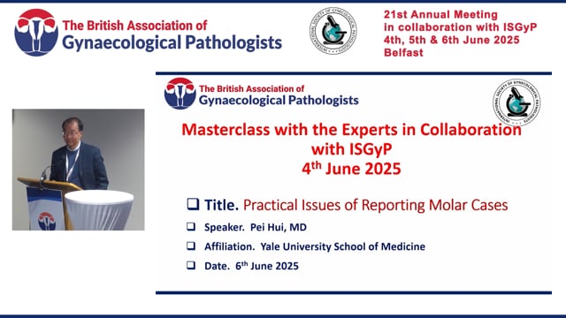Practical issues in reporting molar cases, Prof Pei Hui