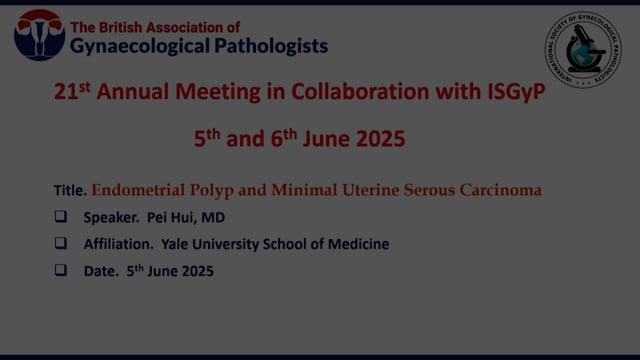 Practical evaluation of endometrial polyp and early serous carcinoma, Prof Pei Hui