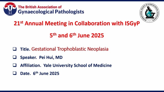 Gestational Trophoblastic Neoplasia, Prof Pei Hui