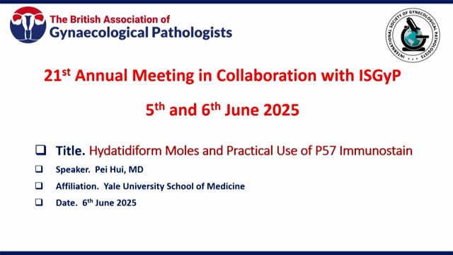 Hydatidiform Moles – Morphologic clues and practical use of p57, Prof Pei Hui