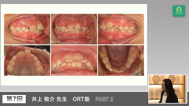 ORT塾 第7回 PART2【期間限定プレミアム公開】
