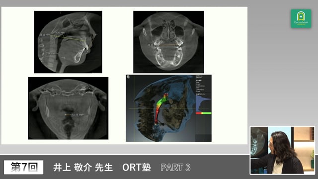 ORT塾 第7回 PART3【期間限定プレミアム公開】