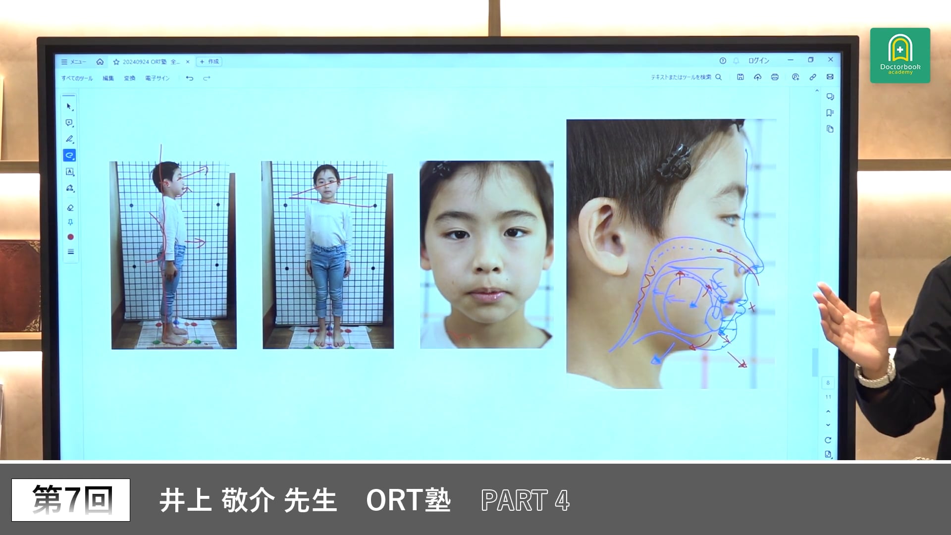 ORT塾 第7回 PART4【期間限定プレミアム公開】