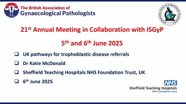 UK pathways for trophoblastic disease referrals, Dr Katie McDonald