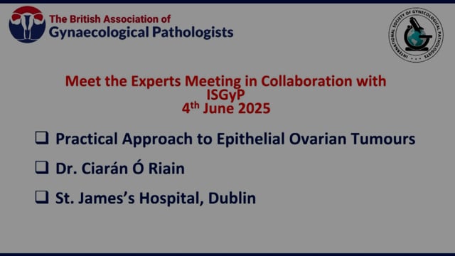 Practical approach to epithelial ovarian tumours, Dr Ciarán Ó Riain
