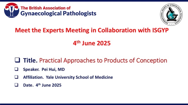 Practical approach to products of conception, Prof Pei Hui