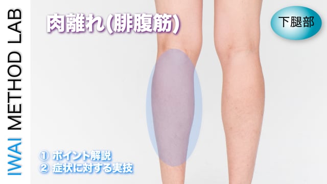 症例別『肉離れ(腓腹筋)』