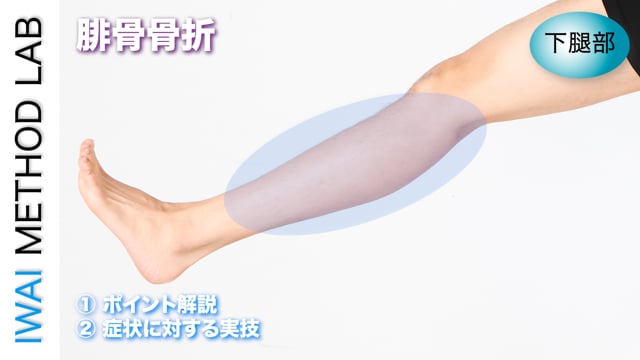 症例別『腓骨骨折』
