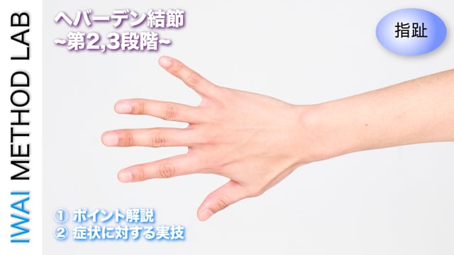 症例別『ヘバーデン結節~第2,3段階~』