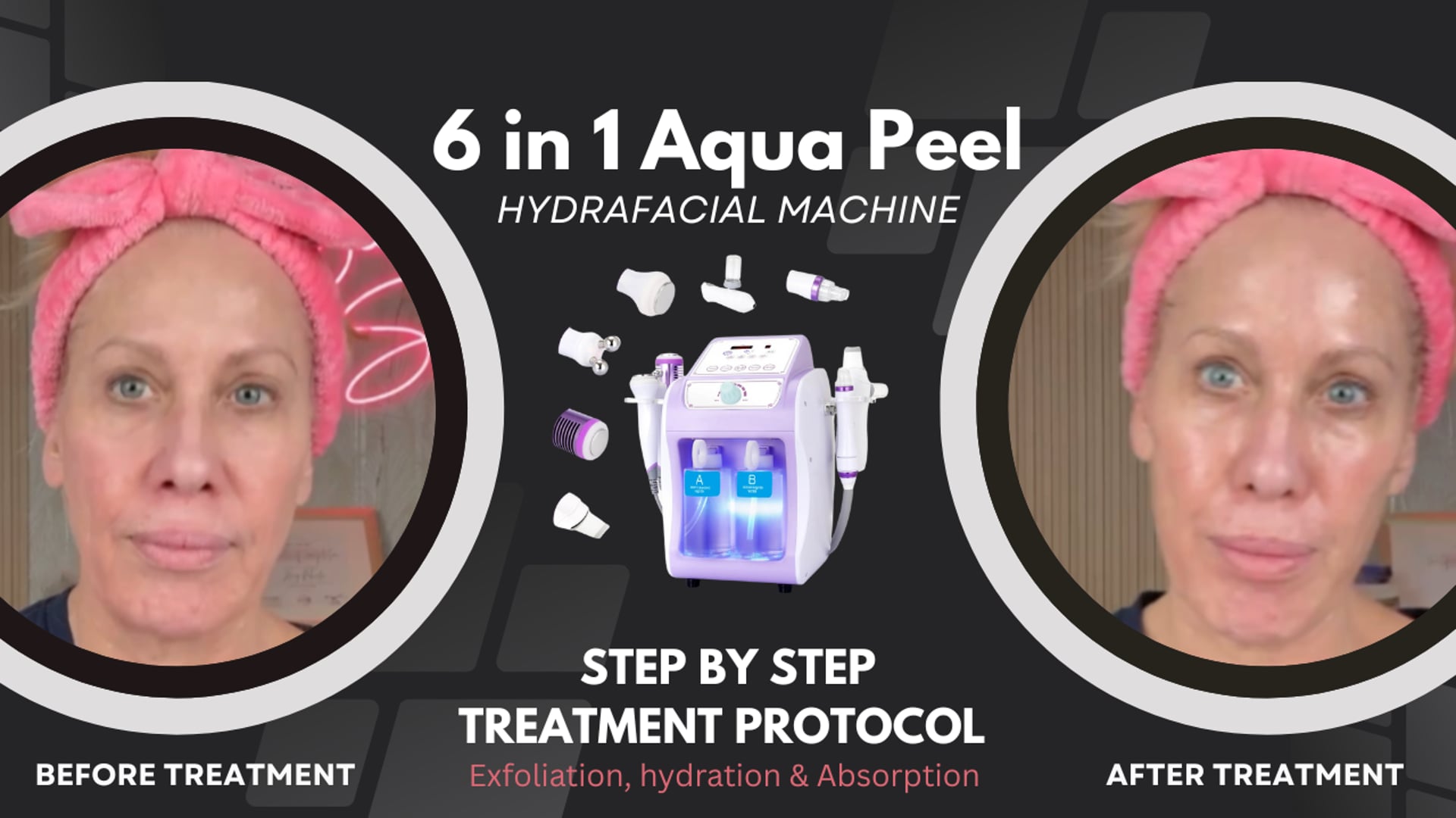 Videos | DIY Sassy Skin LAB