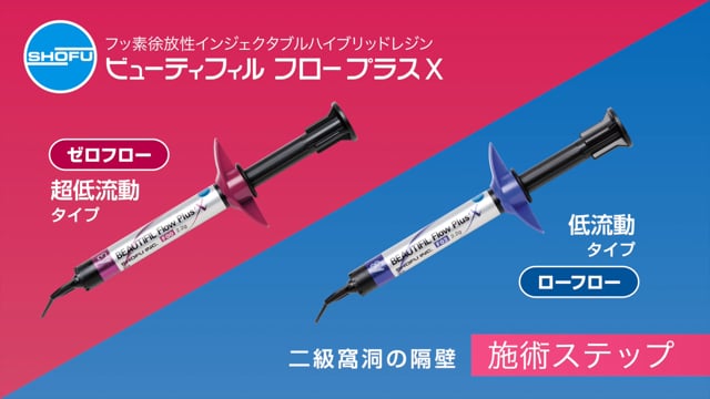 【これが松風のゼロフロー】1分でわかる 二級窩洞の隔壁ステップ