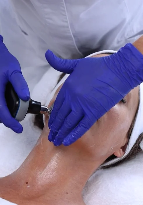 EDNA Pro Max - Radiofrequency for Cellulite & Anti-Aging | INDIBA