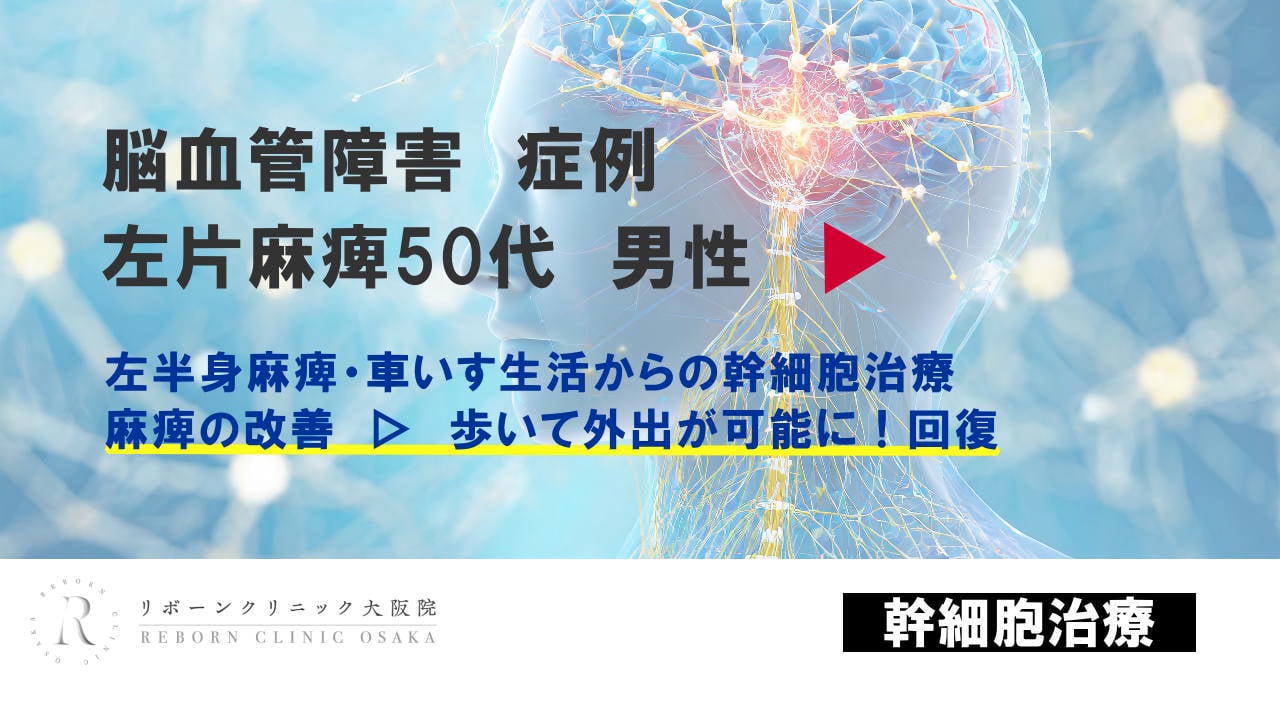 脳血管障害の再生医療｜リボーンクリニック大阪