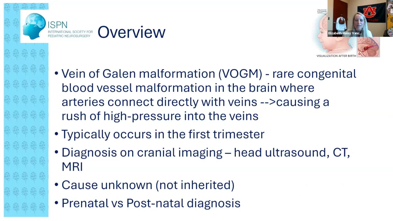 Vein of Galen Malformation