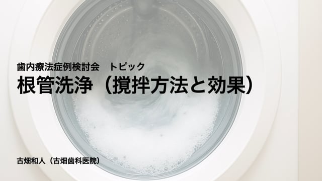 根管洗浄（撹拌方法と効果）｜古畑 和人先生(Essentials)